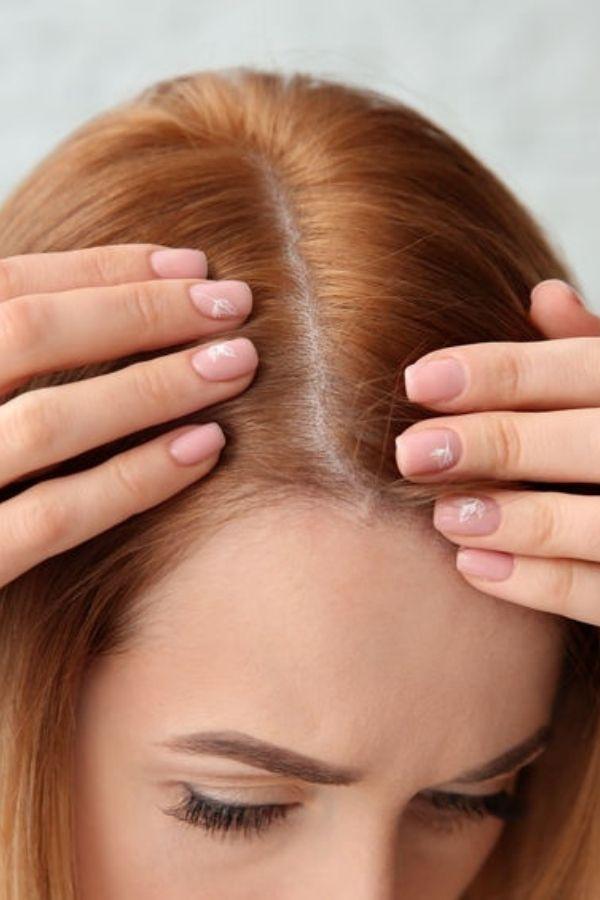 Autumn hair loss symptoms and solutions - Nutree Cosmetics